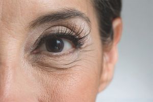 Cómo eliminar las arrugas faciales alrededor de los ojos.