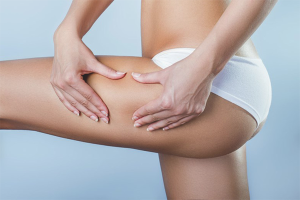 Come combattere la cellulite