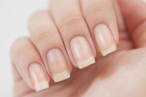 Comment traiter les champignons des ongles