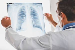 Comment identifier la pneumonie