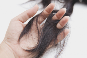 Pérdida de cabello después del parto.