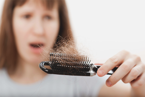 Pérdida de cabello en mujeres.