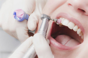 ¿Pueden las mujeres embarazadas cepillarse los dientes?