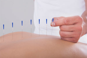 Les avantages et les inconvénients de l'acupuncture